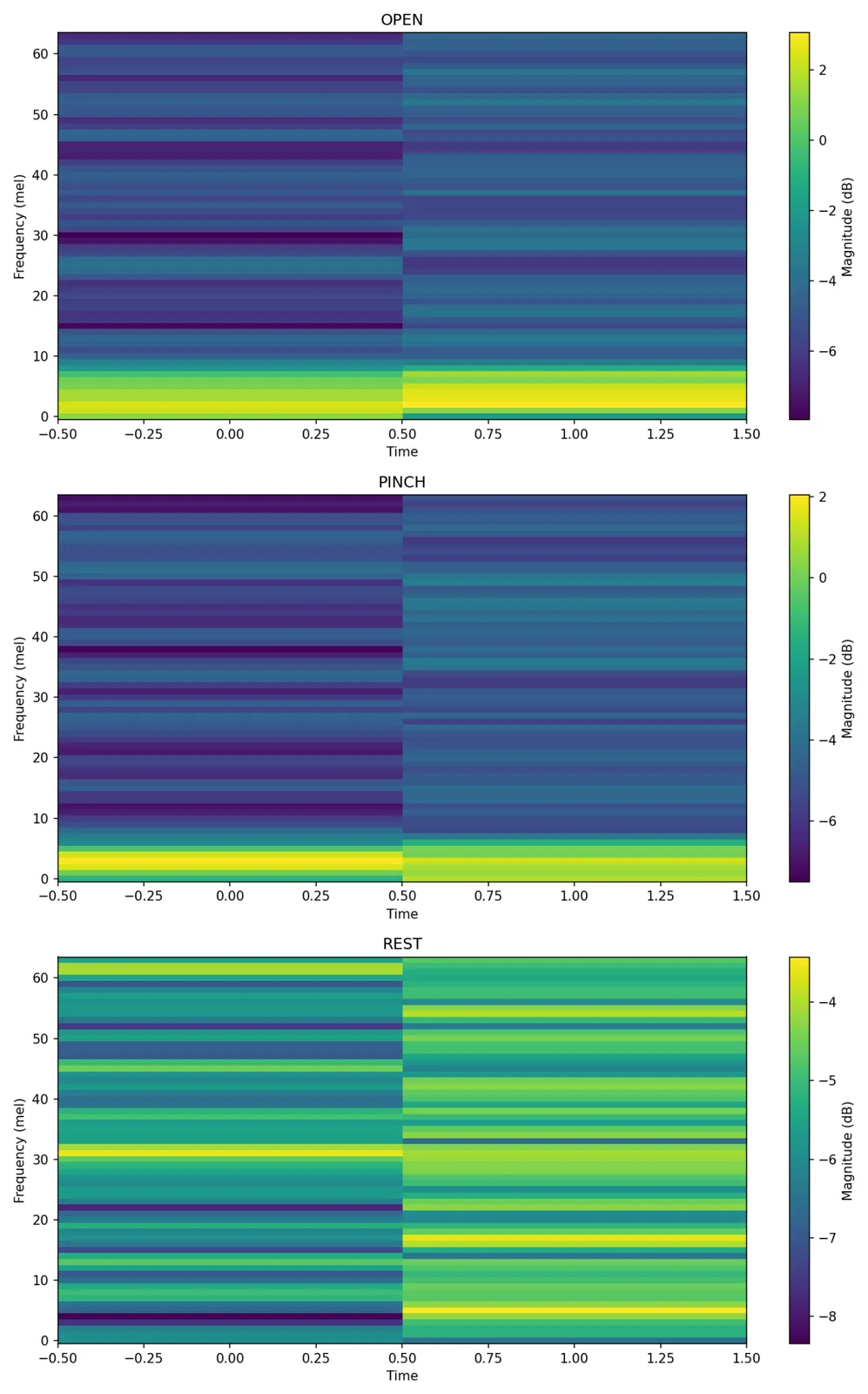 Log-mel spectrograms of 200 ms synthetic windows for the open, pinch and rest gestures across 64 mel bins.